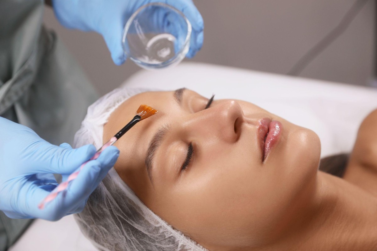 DSC Expands Chemical Peel Treatments for Pigmentation in LA